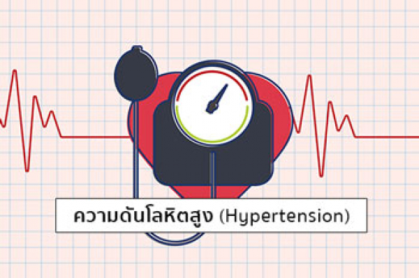 โรคความดันโลหิตสูง (Hypertension)